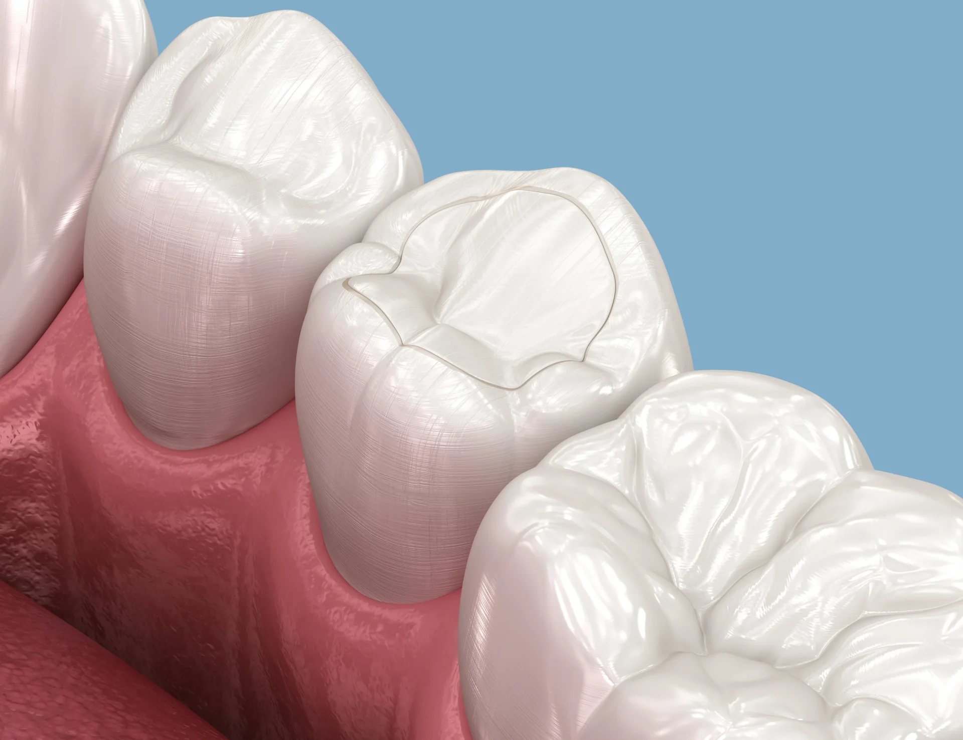 Best Dentist Gulfton