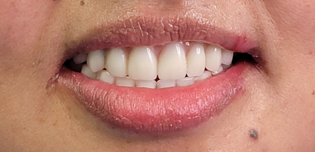 Best Dentist Gulfton